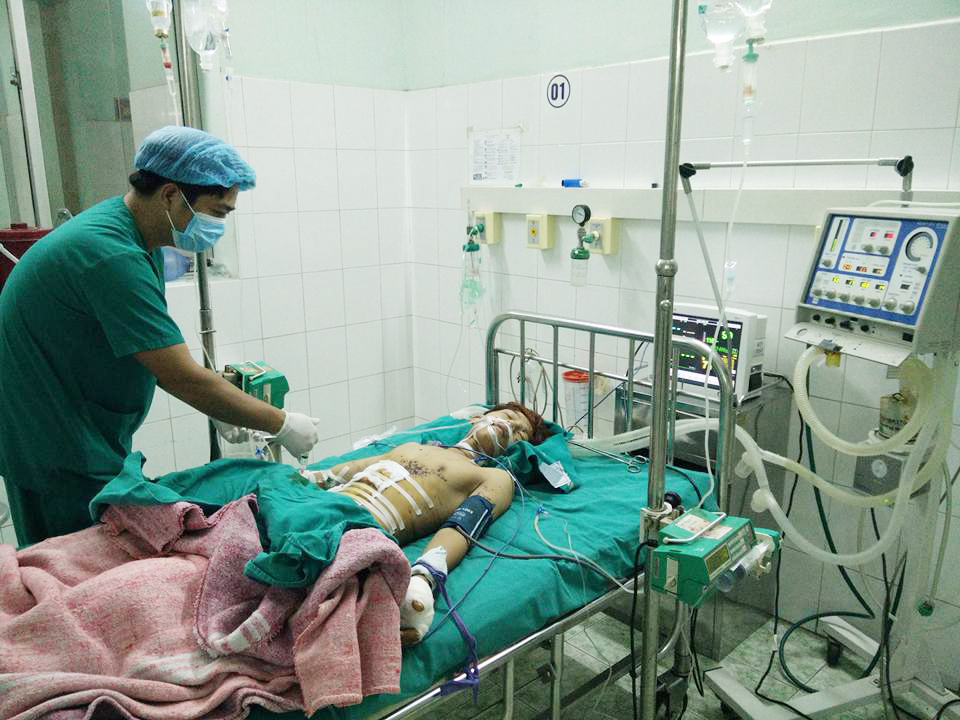 Thủng bụng, mất ng&oacute;n tay do nổ đ&egrave;n pin treo đầu của Trung Quốc