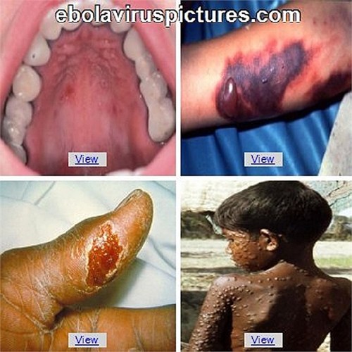 Việt Nam t&igrave;m c&aacute;ch khống chế 'bệnh mới nổi'