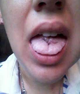 Nạn nh&acirc;n bị kẻ cu&ocirc;̀ng y&ecirc;u cắt lưỡi khi k&ecirc;u cứu 