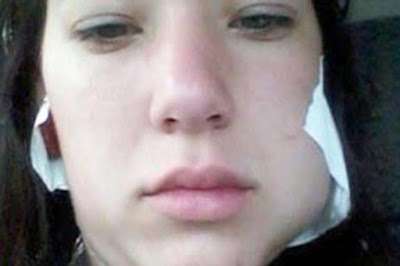 Nicole Kleer, 18 tu&ocirc;̉i bị bạn trai hành hung ngay sau khi c&ocirc; đòi chia tay 