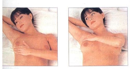 nguy co ung thu vu