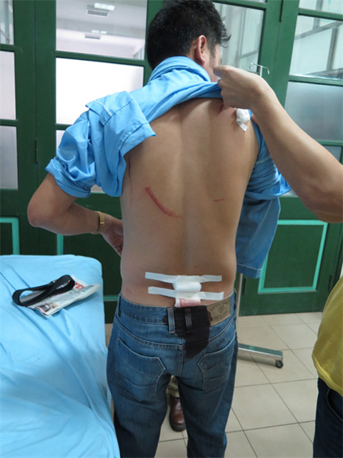 Sau vụ việc nh&agrave; b&aacute;o bị tấn c&ocirc;ng g&acirc;y x&ocirc;n xao, &ocirc;ng Nguyễn Ng. Q. nhập viện với 8 vết ch&eacute;m tr&ecirc;n người