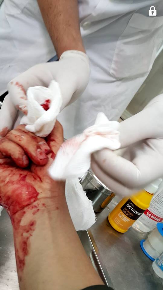 H&igrave;nh ảnh vết thương của nh&agrave; b&aacute;o Đỗ Do&atilde;n Ho&agrave;ng