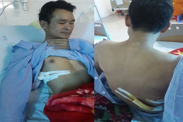 Ủy ban ATGT Quốc gia y&ecirc;u cầu l&agrave;m r&otilde; vụ thanh ni&ecirc;n bị đ&acirc;m v&igrave; cứu người gặp nạn