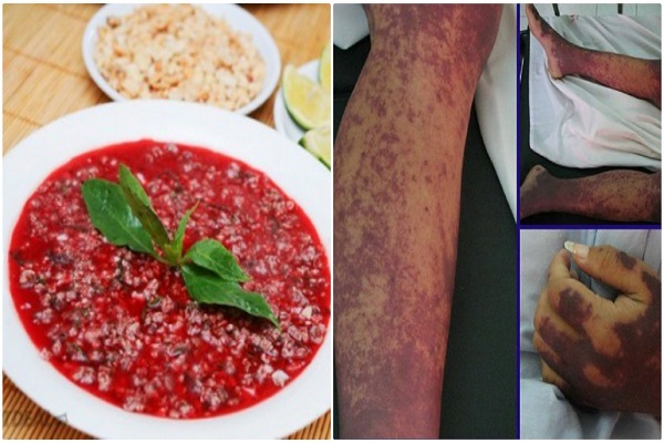 5 biện ph&aacute;p ph&ograve;ng chống li&ecirc;n cầu lợn ai cũng phải 'nằm l&ograve;ng'
