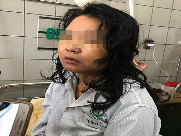 Th&ocirc;ng tin mới nhất vụ nữ điều dưỡng nguy kịch v&igrave; uống thuốc giảm c&acirc;n