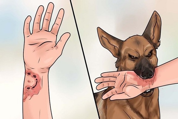 Đừng chủ quan với bệnh dại kẻo c&oacute; ng&agrave;y 'hối cũng kh&ocirc;ng kịp'