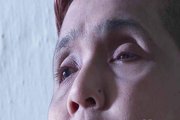 Bỗng nhi&ecirc;n mất lu&ocirc;n đ&ocirc;i mắt v&igrave; tự &yacute; d&ugrave;ng kh&aacute;ng sinh để chữa sốt