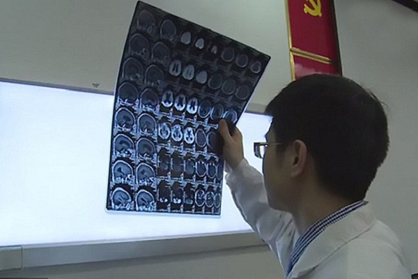 Người đ&agrave;n &ocirc;ng ăn thịt sống bị loại s&aacute;n kinh ho&agrave;ng n&agrave;y chui v&agrave;o trong n&atilde;o