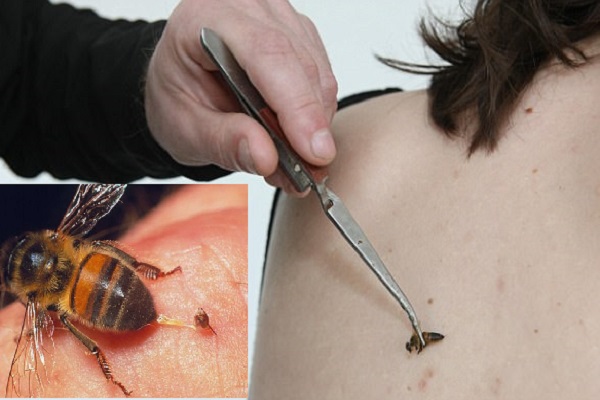 Hi hữu: Người phụ nữ 55 tuổi mất mạng v&igrave; ch&acirc;m cứu bằng c&aacute;ch cho ong đốt