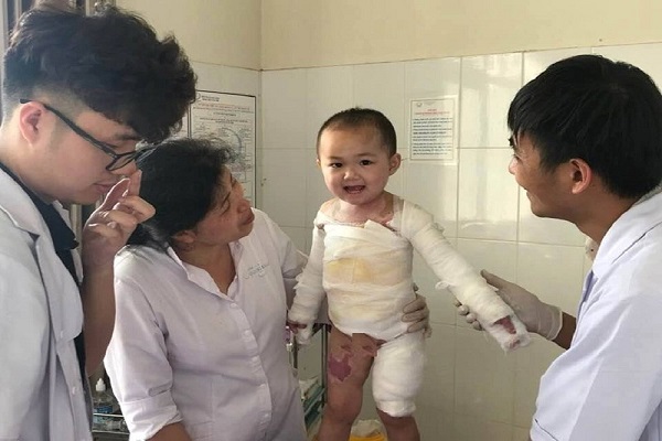 B&agrave; mẹ bất cẩn khiến b&eacute; g&aacute;i 4 tuổi bỏng nước s&ocirc;i to&agrave;n th&acirc;n 