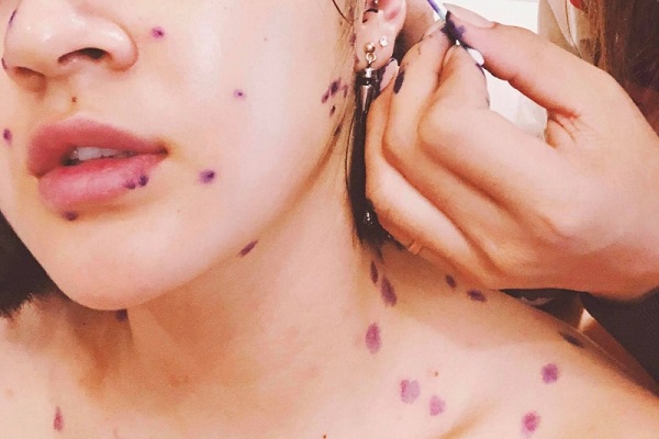 Ca sỹ Bảo Anh hủy h&agrave;ng loạt show v&igrave; bệnh đ&aacute;ng sợ n&agrave;y