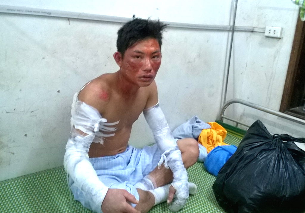 Anh Vi Khắc Nhớ bị thương nặng sau vụ nổ kinh ho&agrave;ng v&agrave; đang được điều trị tại Bệnh viện đa khoa T&acirc;y Bắc Nghệ An