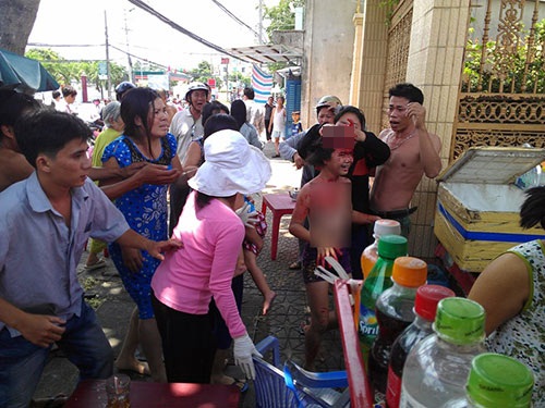 Trước đ&oacute; cũng từng xảy ra vụ việc nữ sinh bị lột da đầu v&igrave; t&oacute;c cuốn v&agrave;o m&aacute;y &eacute;p nước m&iacute;a