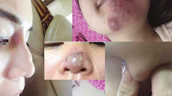 ti&ecirc;m filter hỏng