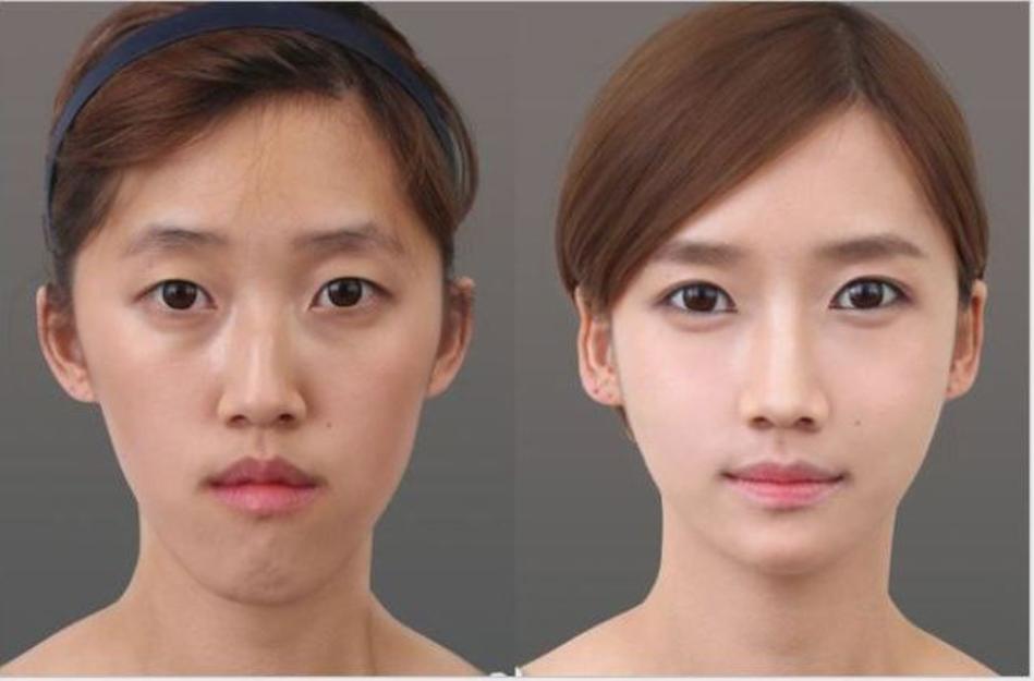 phẫu thuật thẩm mỹ 