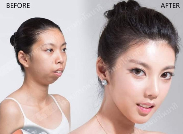 đổi đời nhờ phẫu thuật thẩm mỹ 