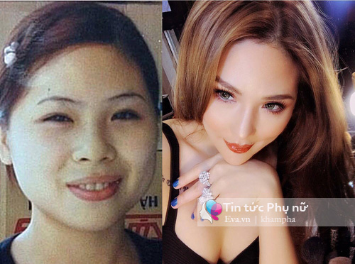 đổi đời nhờ phẫu thuật thẩm mỹ 