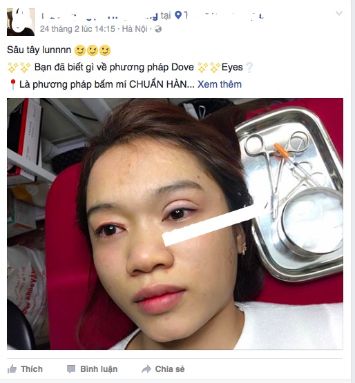 phẫu thuật thẩm mỹ