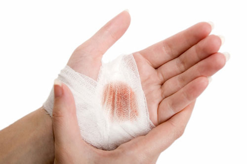 Ph&aacute;t minh mới - băng y tế th&ocirc;ng minh hỗ trợ đắc lực cho việc điều trị c&aacute;c vết thương