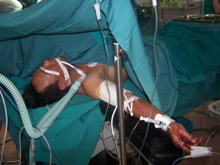 nối th&agrave;nh c&ocirc;ng b&agrave;n tay cho nạn nh&acirc;n Nguyễn Vĩnh Sửu 
