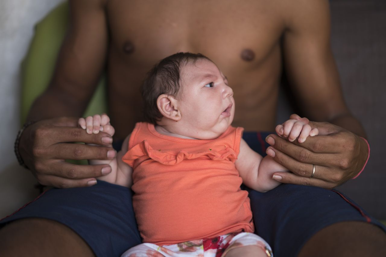 Virus Zika đang bị nghi ngờ l&agrave; nguy&ecirc;n nh&acirc;n g&acirc;y hội chứng đầu nhỏ ở trẻ sơ sinh