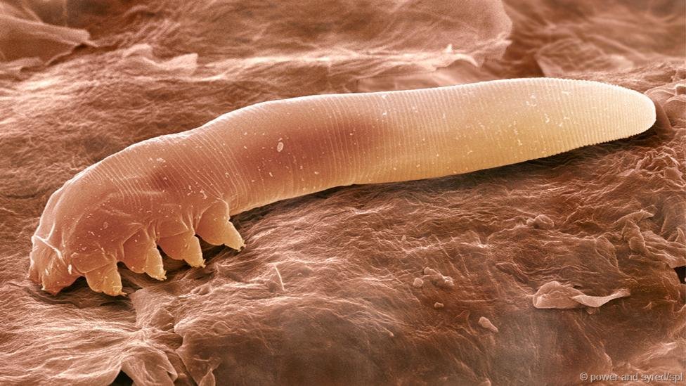 Cấu tạo của Demodex gồm phần đầu với 8 c&aacute;i ch&acirc;n ngắn v&agrave; mập, th&acirc;n tr&ograve;n d&agrave;i khiến ch&uacute;ng nh&igrave;n giống như s&acirc;u