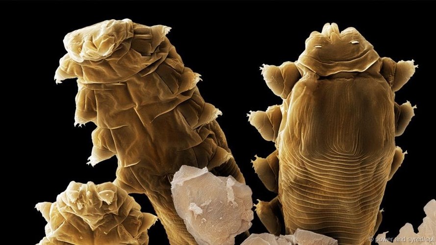Lo&agrave;i rận k&yacute; sinh tr&ugrave;ng n&agrave;y th&iacute;ch sống tr&ecirc;n mặt người c&oacute; t&ecirc;n khoa học l&agrave; Demodex