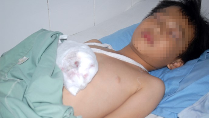 Người nh&agrave; của Nhật cho biết, cục sạc bị n&aacute;t vụn văng tứ tung sau khi ph&aacute;t nổ