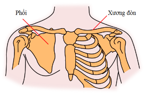 Sơ cứu g&atilde;y xương đ&ograve;n hiệu quả, nhanh ch&oacute;ng
