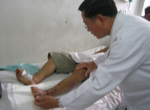 H&uacute;t nọc độc l&agrave; biện ph&aacute;p được sử dụng nhiều để sơ cứu khi bị rắn cắn, nhưng kh&ocirc;ng mang lại lợi &iacute;ch g&igrave;