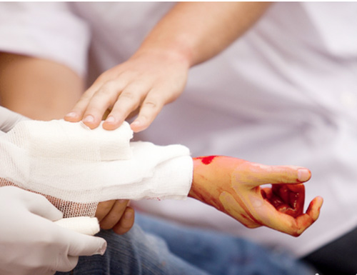C&aacute;ch sơ cứu vết thương hiệu quả, nhanh ch&oacute;ng