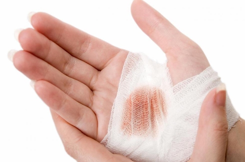 C&aacute;ch sơ cứu vết thương hiệu quả, nhanh ch&oacute;ng