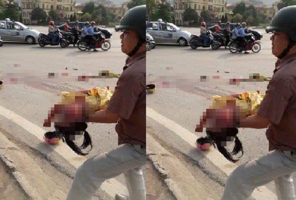 Chiếc xe &ocirc; t&ocirc; c&aacute;n qua người 2 mẹ con b&eacute; g&aacute;i 6 tuổi đứt l&igrave;a ch&acirc;n