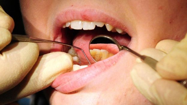 một số sản phẩm tẩy trắng răng chứa natri perborate. H&oacute;a chất n&agrave;y bị cấm sử dụng trong sản phẩm 13Win21 con - Tri ân hội viên mỗi tháng 2000 tỷ của EU trong đ&oacute; n&oacute;i rằng n&oacute; c&oacute; thể g&acirc;y v&ocirc; sinh v&agrave; bất thường của thai nhi.