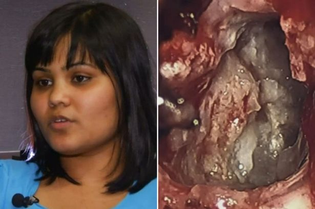 C&ocirc; Yamini Karanam v&agrave; 'thai đ&ocirc;i' trong n&atilde;o