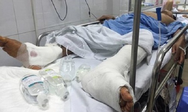 Trong những tin tức thời sự 24h h&ocirc;m nay c&oacute; việc b&aacute;c sĩ BV Việt Đức mổ nhầm ch&acirc;n