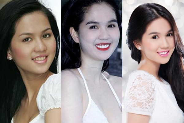 Ngọc Trinh khi chưa nổi tiếng không những có làn da đen nhẻm mà thậm chí hàm răng của “Nữ hoàng nội y” còn khá vàng và không đều như bây giờ