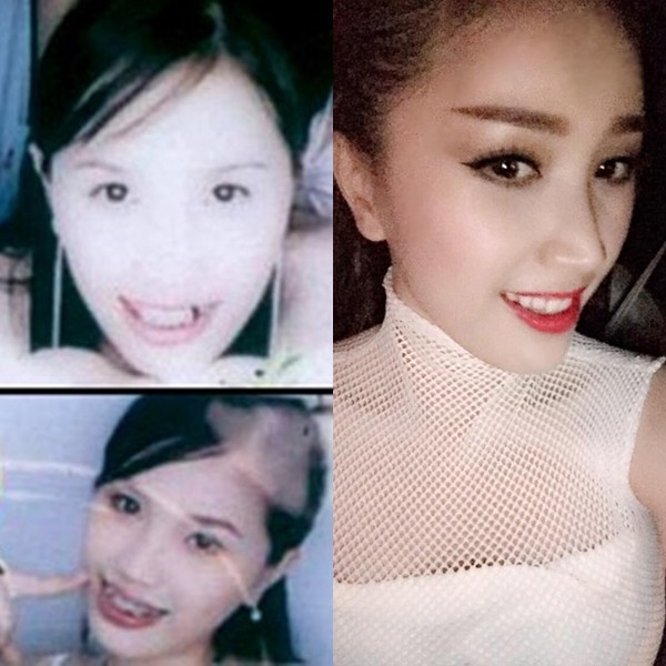 Bảo Thy của thời điểm hiện tại và hình ảnh cô ca sĩ mạng ngày xưa với hàm răng khá quê mùa