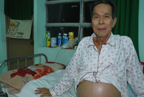 Th&agrave;nh Lũy v&agrave; phận đời nổi n&ecirc;nh, s&oacute;ng gi&oacute;