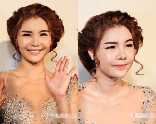 khu&ocirc;n mặt sưng phồng kh&aacute;c lạ của Kỳ H&acirc;n