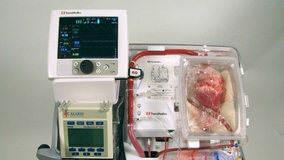  Thiết bị chăm s&oacute;c nội tạng (OCS) gi&uacute;p phục hồi chức năng quả tim trước khi thực hiện cấy gh&eacute;p tim