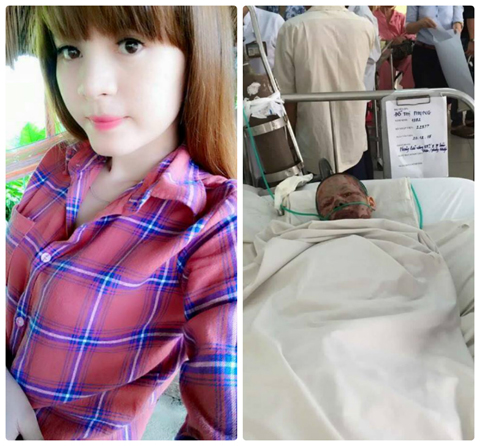Ch&acirc;n dung Phụng trước v&agrave; sau khi bị tạt xăng đốt