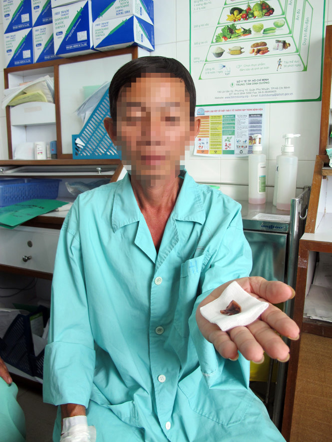 Nạn nh&acirc;n bị h&oacute;c dị vật sau khi thực hiện phẫu thuật