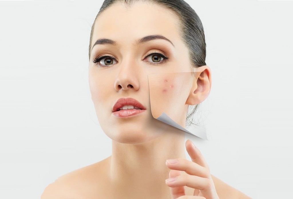 Tẩy nốt ruồi l&agrave; một việc nguy hiểm, cần c&oacute; sự tư vấn của b&aacute;c sỹ