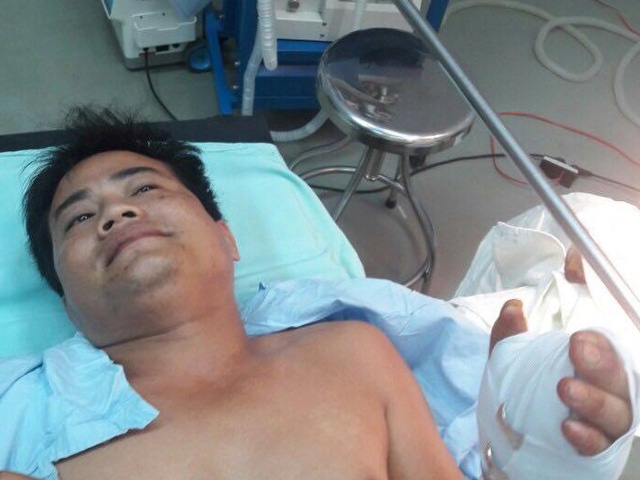 Anh H&ugrave;ng chấn thương nghi&ecirc;m trọng v&igrave; s&uacute;ng b&uacute;t