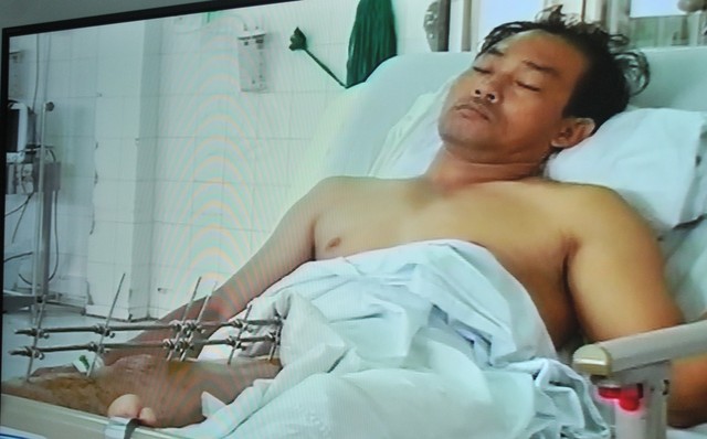 Nguyễn H&ugrave;ng Cường, một trong số những người bị thương, đang được điều trị trong bệnh viện