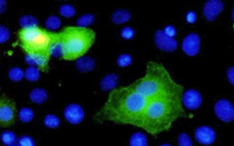 Virus MERS -coV dưới ống k&iacute;nh hiển vi