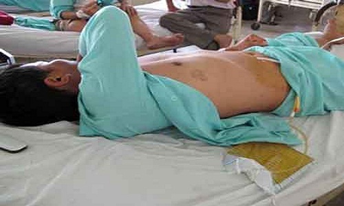 Tin tức mới nhất đề cập đến vụ việc vợ cắt 'của qu&yacute;' của chồng ở Nam Định
