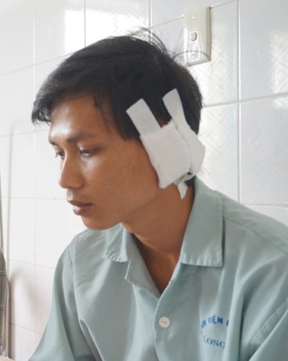Anh Tuấn đ&atilde; bị đối tượng T&acirc;m ch&eacute;m đứt tai bằng con dao d&agrave;i 5 tấc